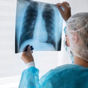 Oklahoma City Mesothelioma Lawyer Vimeo: Finding the Right Legal Support